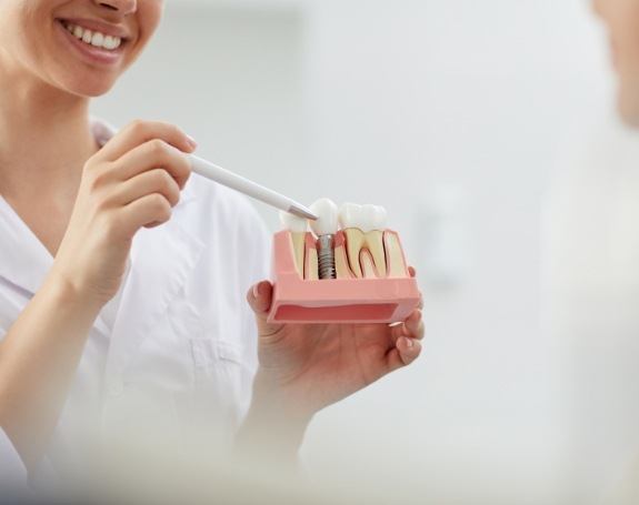 Dentist showing patient model comparing natural tooth to dental implant supported dental crown