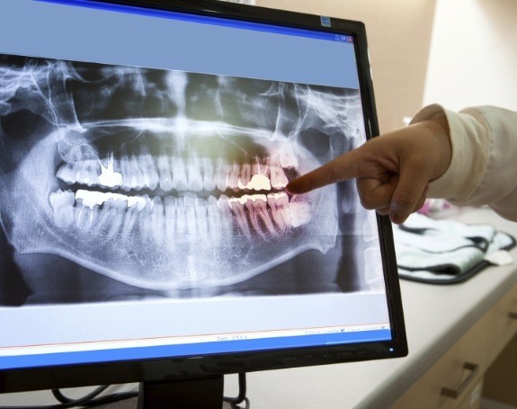 Digital x-rays on chairside computer