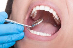 woman with open mouth at dentist 