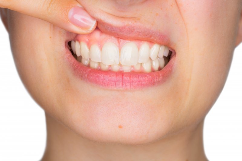 Woman with healthy gums