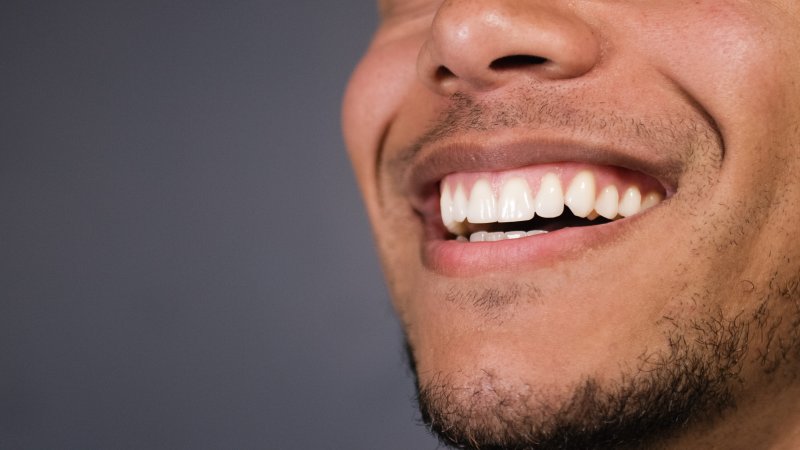 Man after teeth whitening