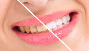 Did you know your smile can be drastically improved by your cosmetic dentist in Painesville? 